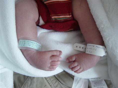According to the nhs website, it happens because the achilles. Clubfoot Challenges And Victories - A Parent's Story ...