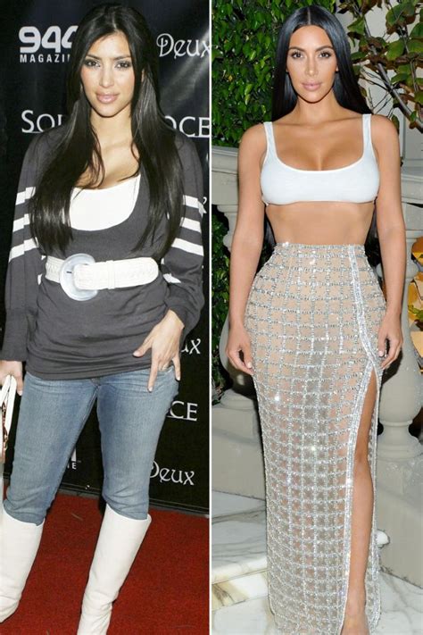 Kim Kardashian Before And After Experts Have Their Say On Speculated