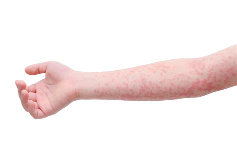 18-HPUL-5572 Flu Infographic