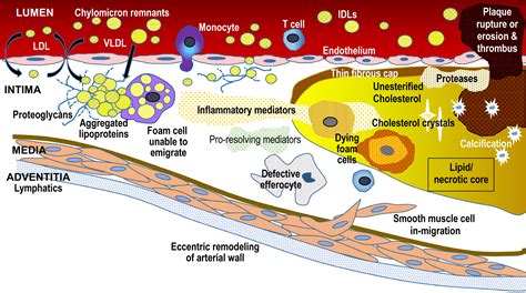 Eradicating The Burden Of Atherosclerotic Cardiovascular Disease By