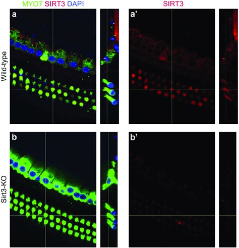 Sirt3 Is Expressed In Sensory Cells Of The Adult Mouse Cochlea A
