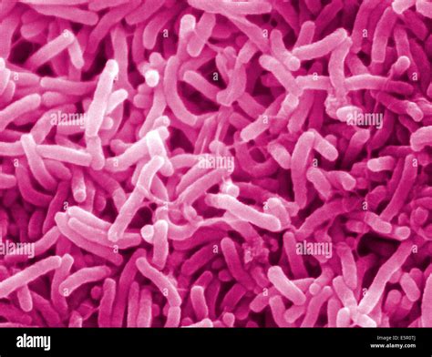Scanning Electron Micrograph Sem Of Vibrio Cholerae Bacteria This