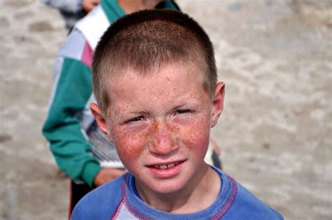 Portrait Of A Little Boy Cute Face Stock Photo Image Of Freckles