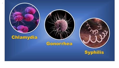 Dr Cs Journal What Are Symptoms Of Gonorrhea Doctors Without