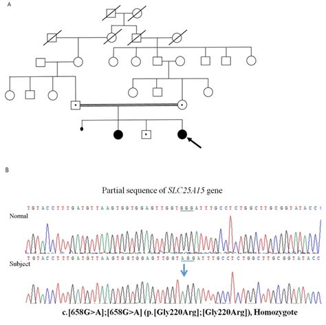 Pedigree And Sanger Sequencing Of Slc25a15 In The Download Scientific Diagram