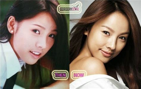 Lee Hyori Plastic Surgery Nose Job Before And After Breast Implants Eyelid Surgery Photos