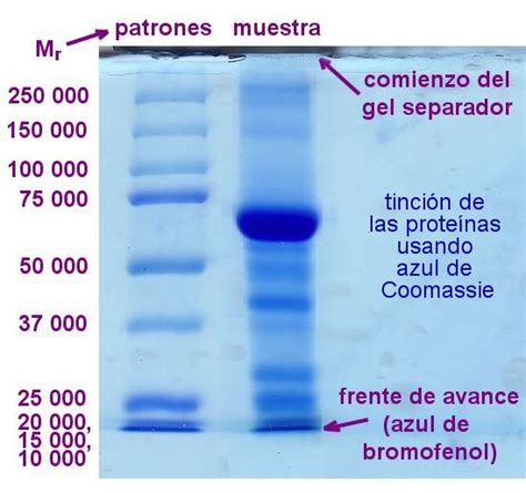 Protein electrophoresis is a method for analysing the proteins in a fluid or an extract. Electroforesis