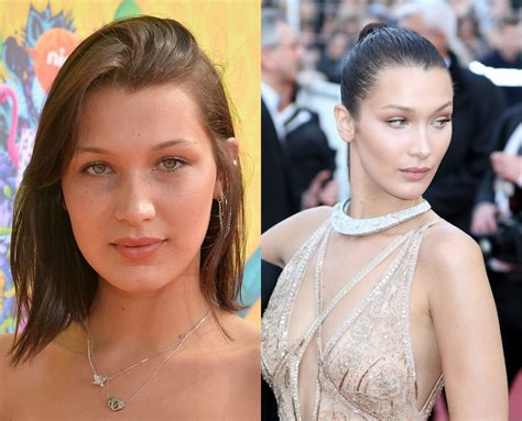 celebrity plastic surgery 30 before and after pics stylecaster