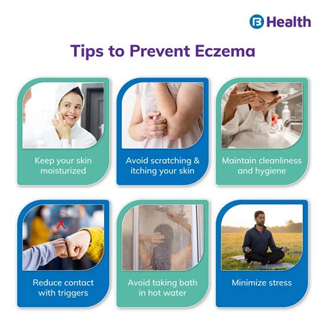 Eczema Its Symptoms Causes Treatment And More