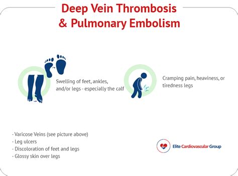 Deep Vein Thrombosis And Pulmonary Embolism Elite Cardiovascular Group