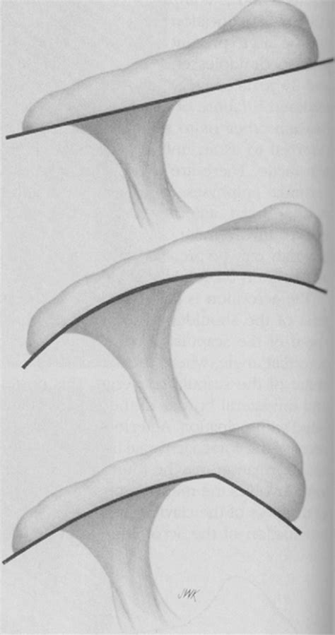 Shoulder Anatomy And Biomechanics Musculoskeletal Key