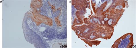 Representative Pictures Of Immunohistochemical Staining Of P16 A