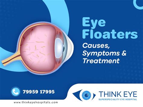 Eye Floaters Treatment In Hyderabad Think Eye Hospitals