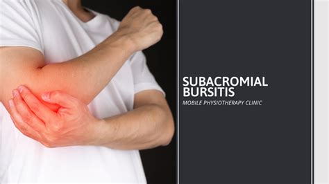 Shoulder Impingement And Subacromial Bursitis Physiot Vrogue Co