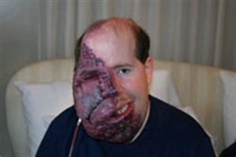 We did not find results for: pictures of birthmarks - pictures, photos