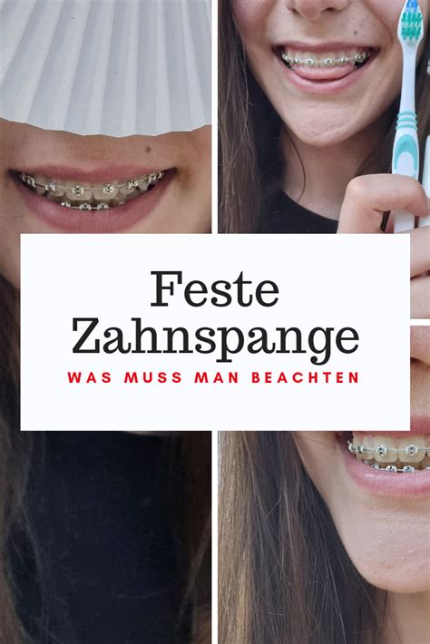 Mein sohn hatte seine feste zahnspange nur etwa 1,5 jahre. Wie Sieht Man Mit Zahnspange Aus - Wie Man