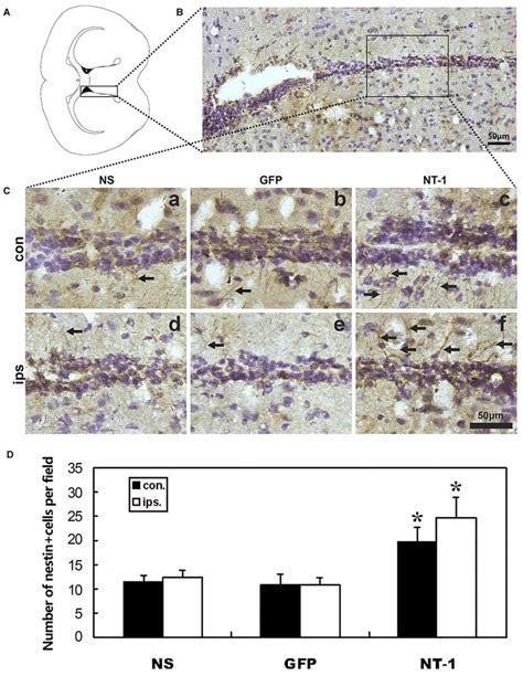 Nestin Expression In The Region Of Subventricular Zone Svz In