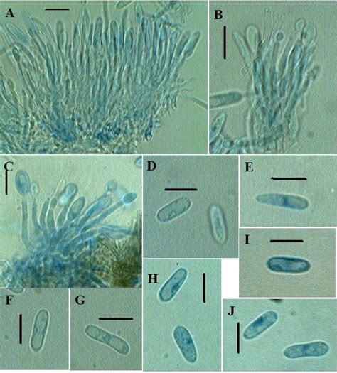 Colletotrichum Musae A C Conidiogeneous Cells Bearing Conidia D J