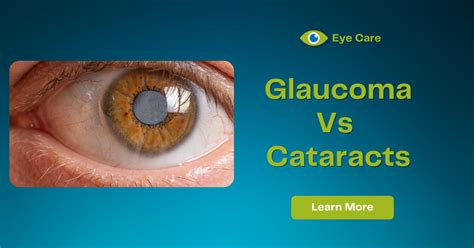 The Difference Between Cataracts And Glaucoma Anderson And Shapiro Eye Care