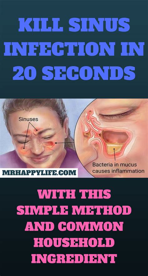 sinusitis commonly known as a sinus infection is the inflammation of the lining walls of the