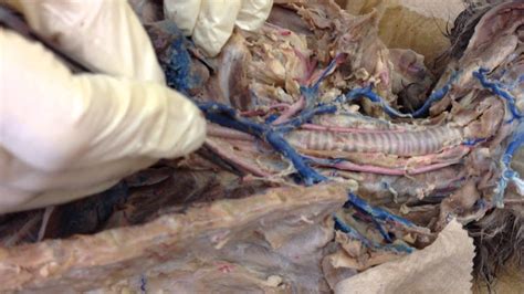 The vessels of the neck must not only supply and drain cervical structures but also those in the head. Dissection of Cat Vessels - YouTube
