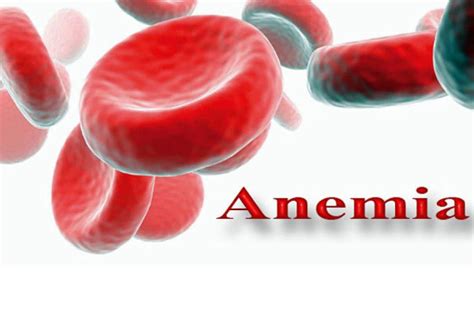 ¿Qué es Anemia? » Su Definición y Significado 2020