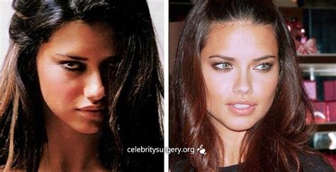 Celebrity Model Adriana Lima Before And After Plastic Surgery Nose Job