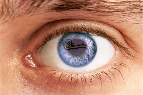 Ebola Lurked In Patients Eye Turning It From Blue To Green D Brief
