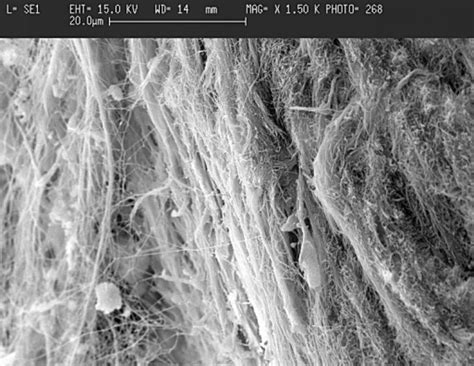 Scanning Electron Micrograph Sem Of Collagenous Fibers Of Predentin