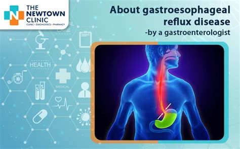 About Gastroesophageal Reflux Disease By A Gastroenterologist The