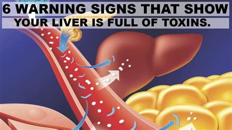 6 Warning Signs That Show Your Liver Is Full Of Toxins Signs Of Liver