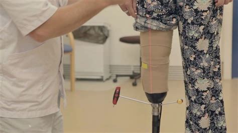 The Friendships Made In A Prosthetics Fitting Room Bbc News
