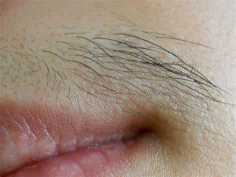 No Shaving Allowed In Between Treatments Professional Electrolysis