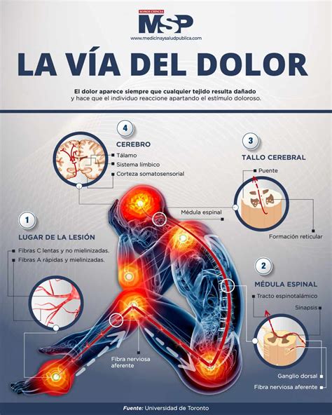 La Vía Del Dolor Infografía