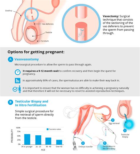 can i become a father after a vasectomy eugin ivf clinic