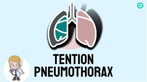 Tension Pneumothorax Explained Usmle Youtube