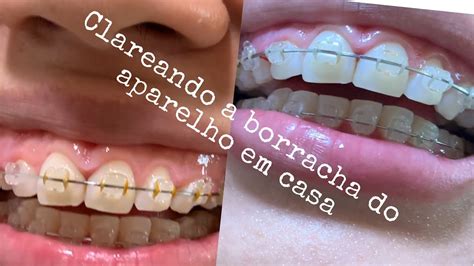 Borrachinha Branca De Aparelho