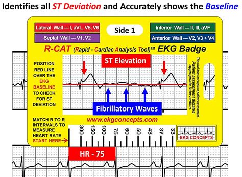 R-CAT for Arrhythmias EKG Pocket Reference Guide Plus EKG Badge – Great