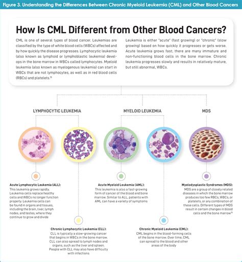 Conquer The Journey Informed Resistant Chronic Myeloid Leukemia