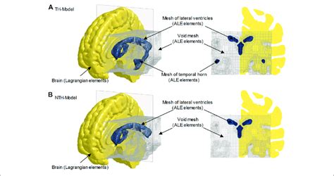 Brain Ventricle Interfaces Of The Th Model A And Nth Model B For