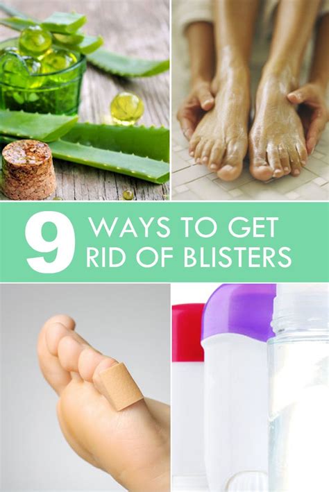 9 Ways To Get Rid Of Blisters Beauty Tips Tricks Hacks Lifehacks