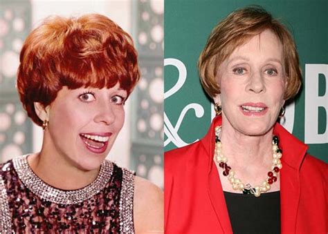 Carol Burnett Plastic Surgery Before And After