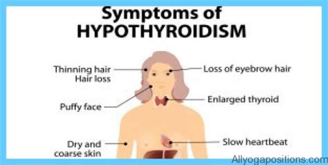 Graves disease is an autoimmune disorder of the thyroid gland in which patients develop antibodies. Graves' Disease Graves Hyperthyroidism - AllYogaPositions ...