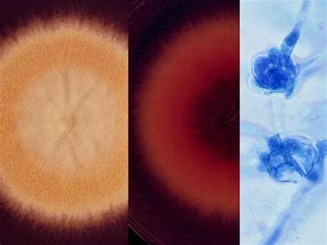 Trichophyton Mycology University Of Adelaide