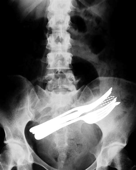20 Of The Worlds Most Bizarre X Rays X Ray Weird Pictures Bizarre