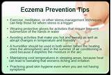 Pictures of Weeping Eczema Treatment