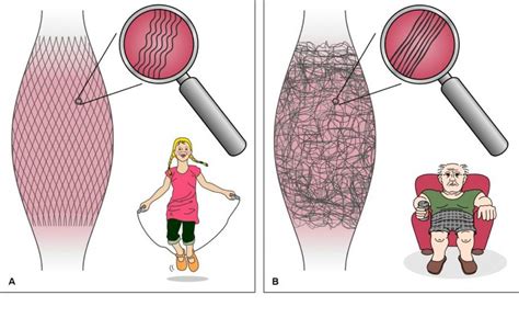 What Is Fascia Bendable Body