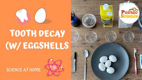 Tooth Decay W Eggshells Youtube