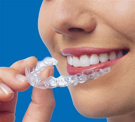 You can pay for your braces using insurance, but it depends because most don't cover dental. Top 20 Things to Know Before An Invisalign Treatment | Locust Family Dentistry