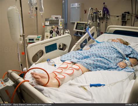 Stock Image Female Patient In An Intensive Care Unit Icu On A